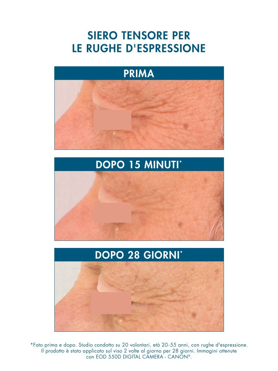 MULTI-PEPTIDE 20% LIFTING SERUM