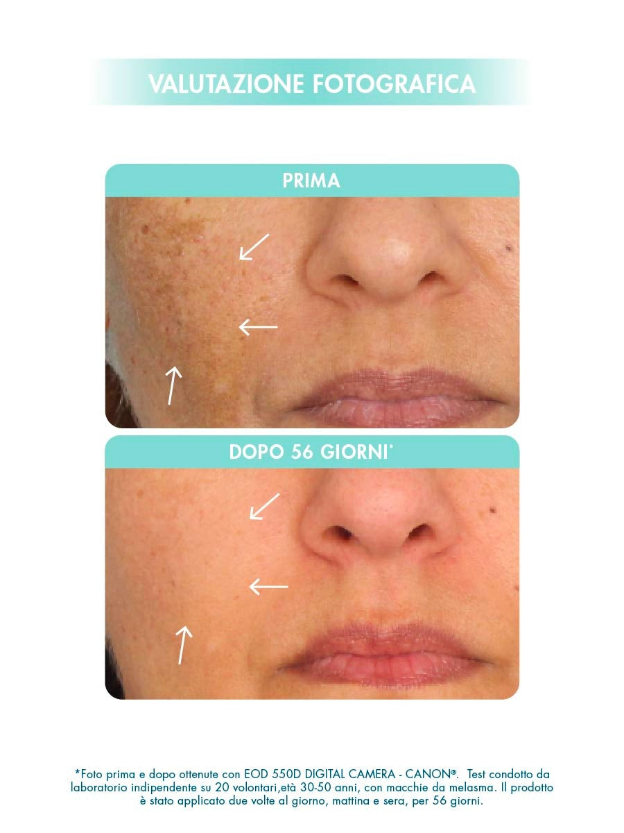 PIGMENT CONTROL ADVANCED SERUM